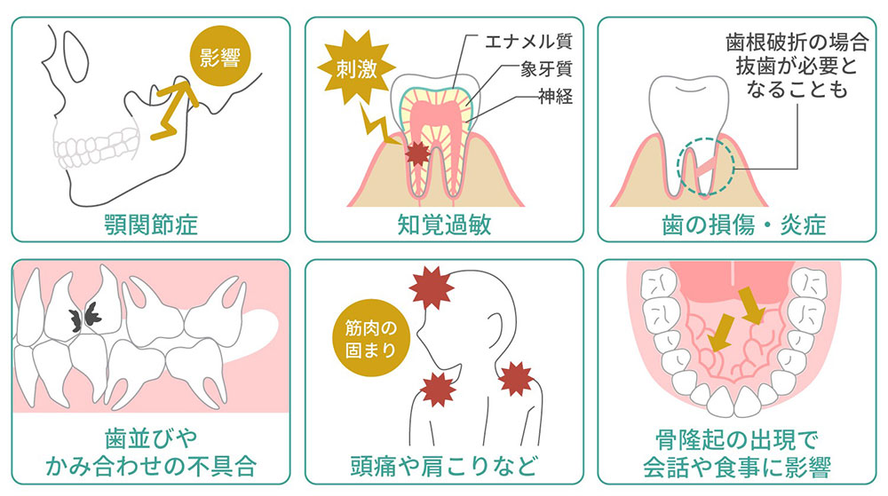 歯ぎしりがもたらすトラブル