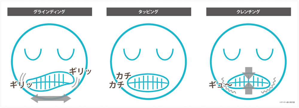 寝ているときの歯ぎしり