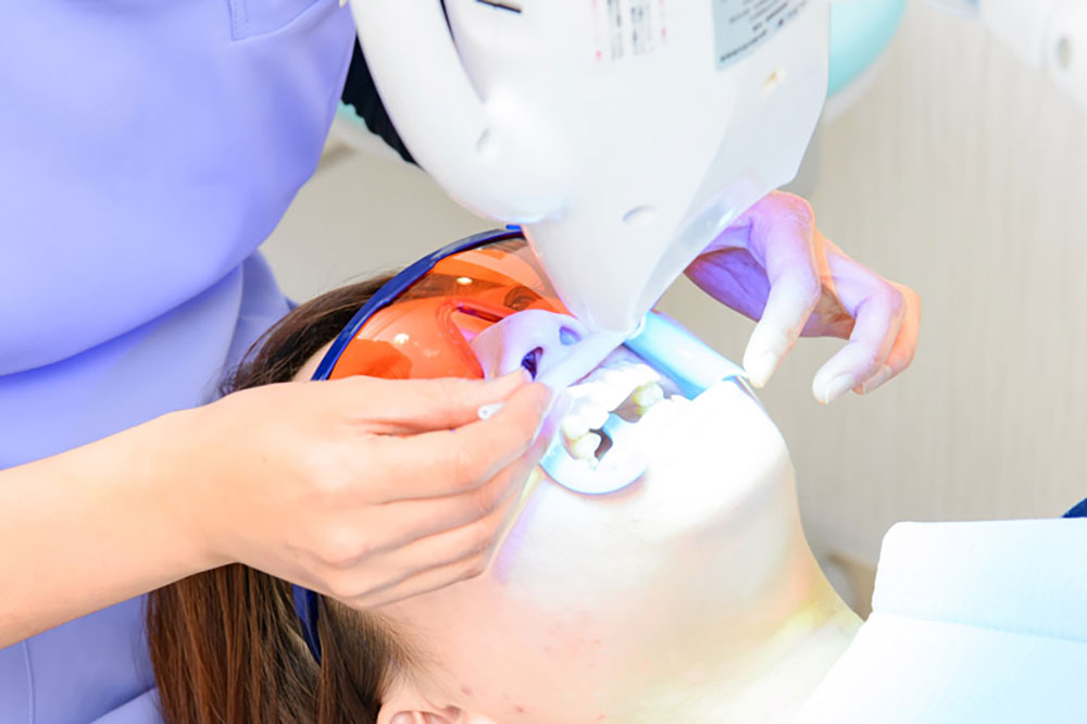 「オフィスホワイトニング」とは？