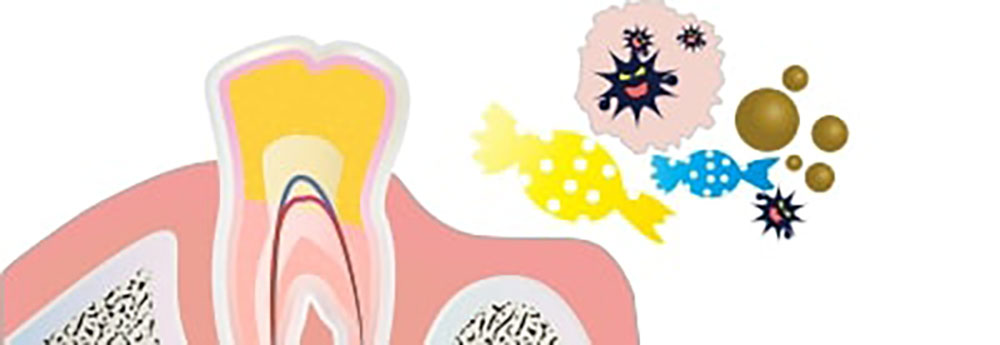 むし歯になるまでの流れ