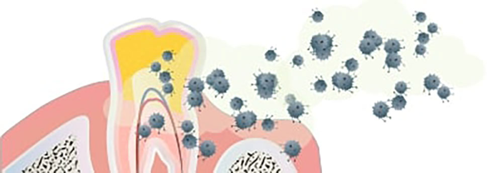 細菌にとって、プラークは快適な環境なので、どんどんと増殖していきます