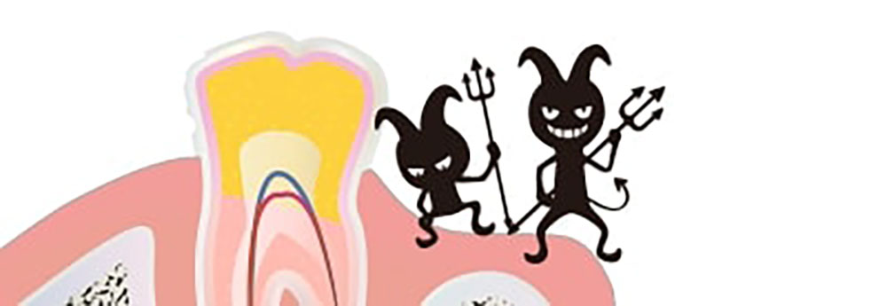 細菌は歯を溶かす酸を作ります