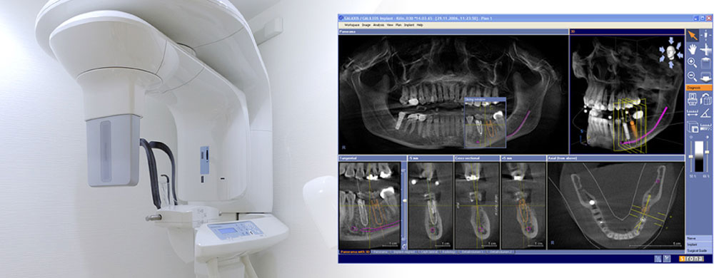 CT撮影による検査の様子