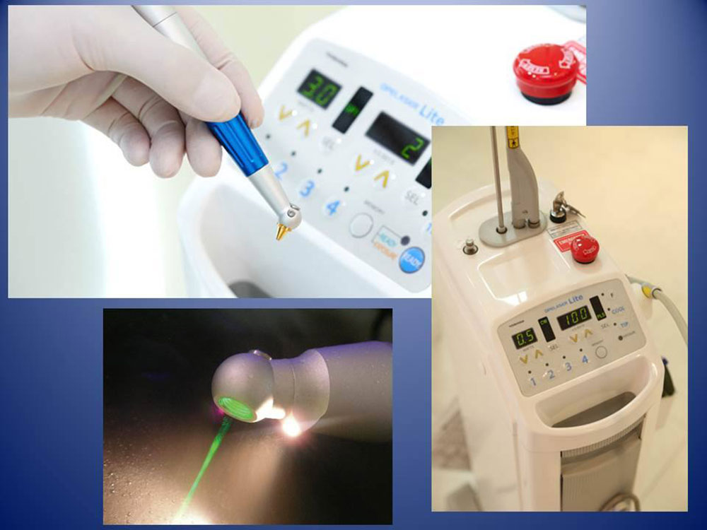 レーザー治療器