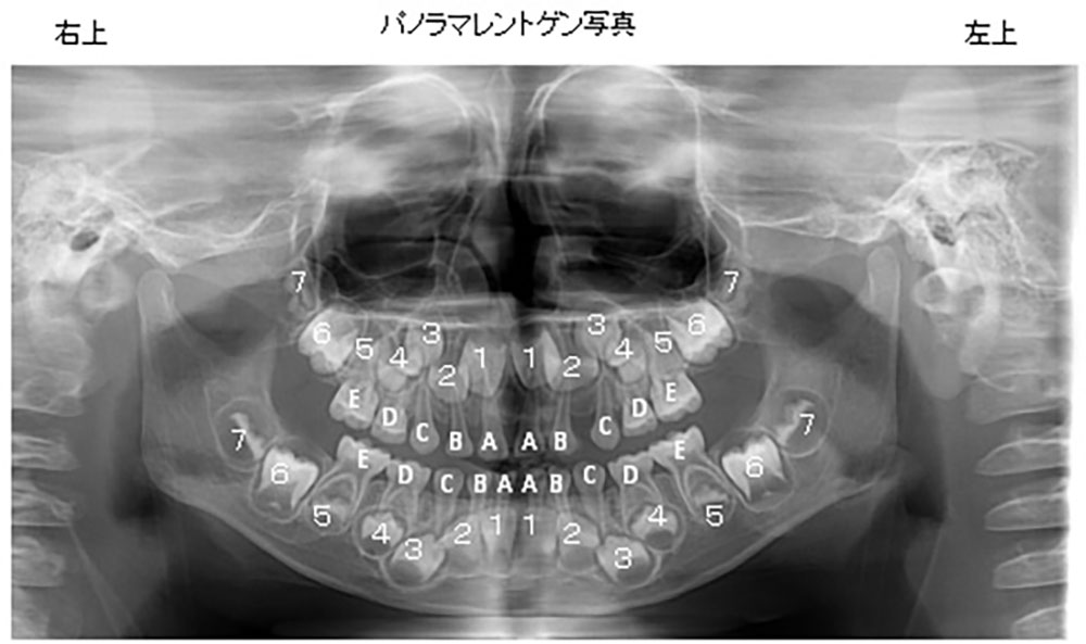 子どものお口は、変化が激しい