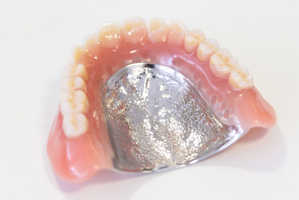 金属床義歯