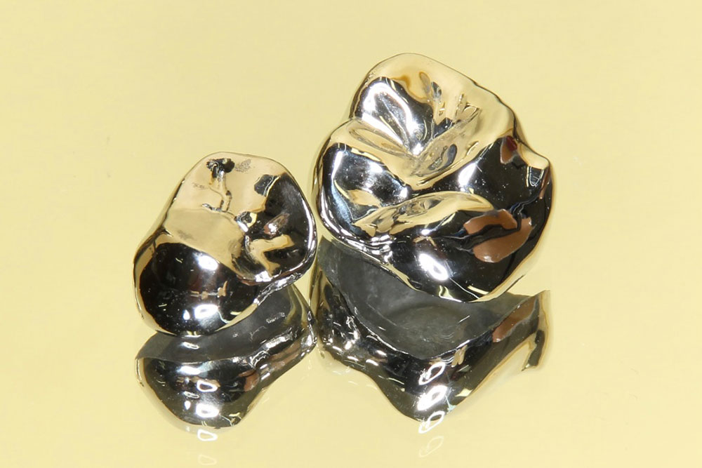 歯科金属アレルギー お口の中の金属が原因かも？