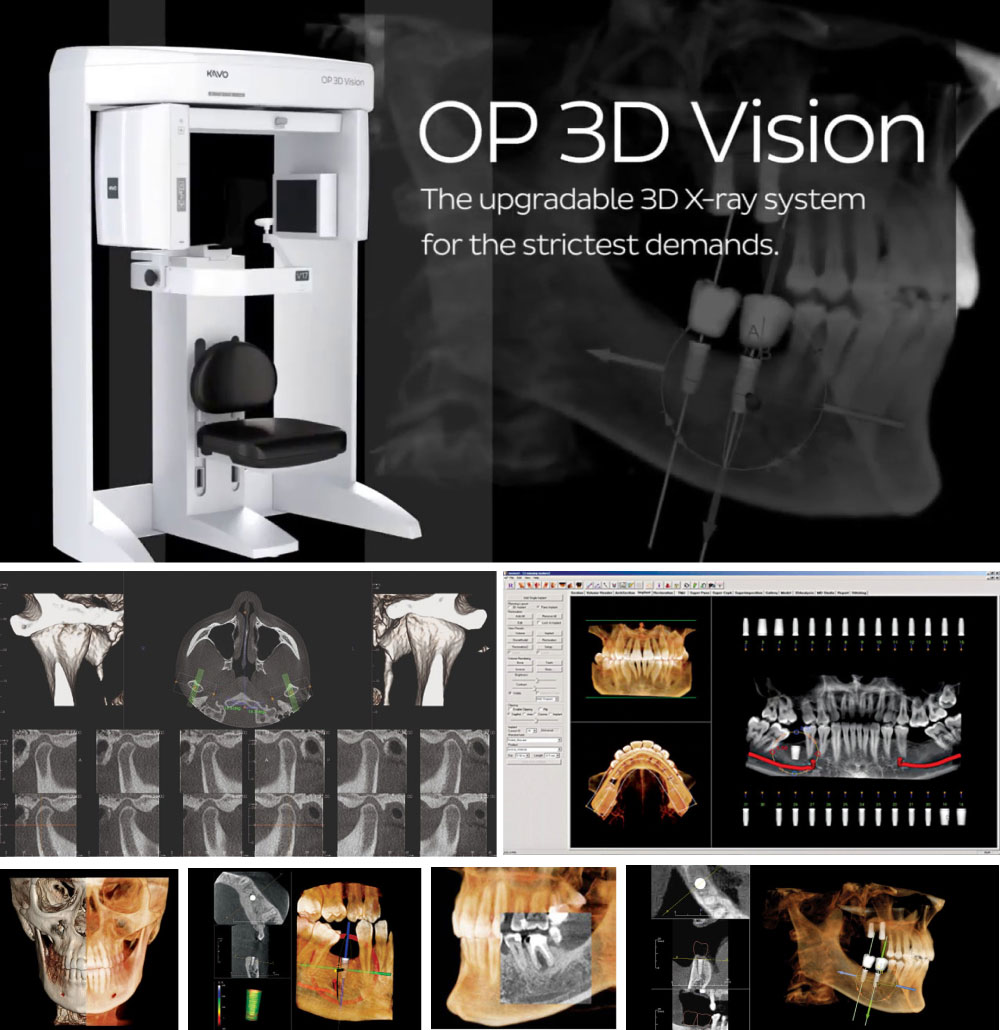デジタルX線CT撮影装置