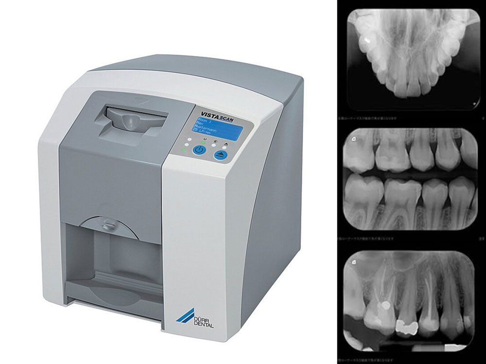 歯科X線撮影装置(デントナビ)、デジタルX線スキャナー(VISTA SCAN MINI、ドイツ製)