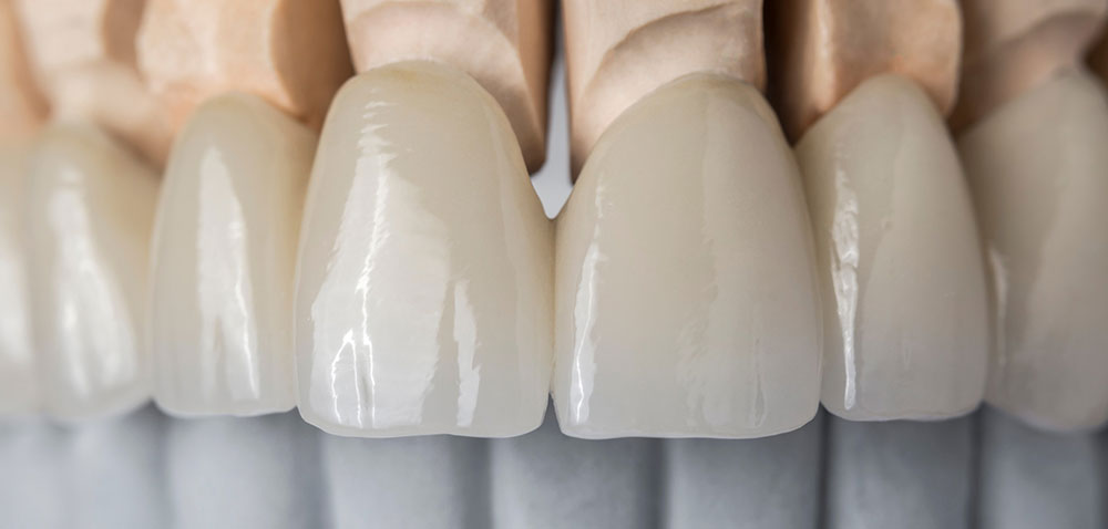 セラミックの写真