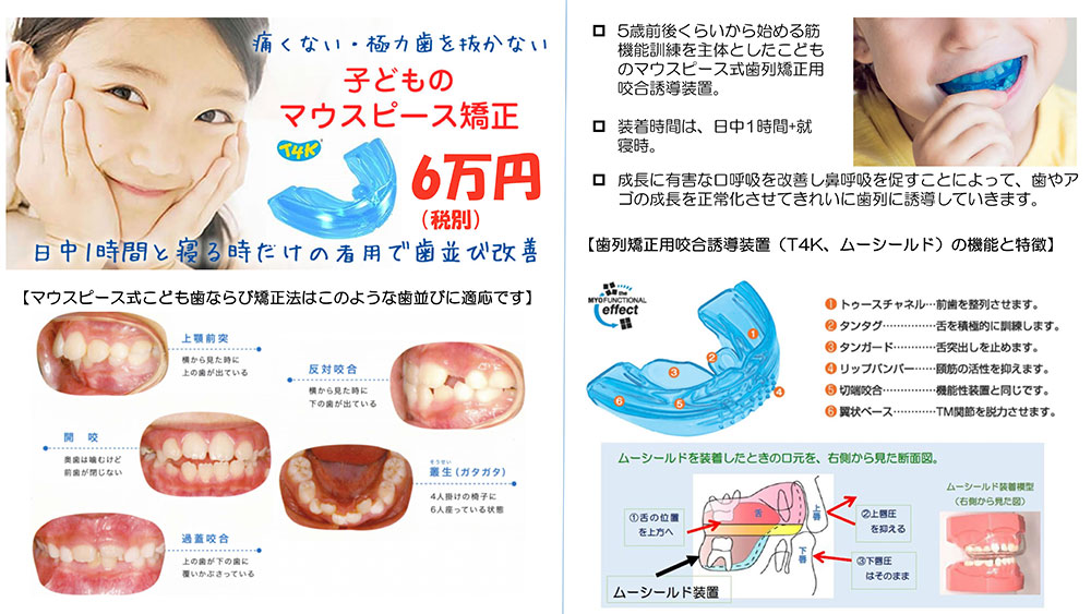 子どもの矯正歯科の説明と案内