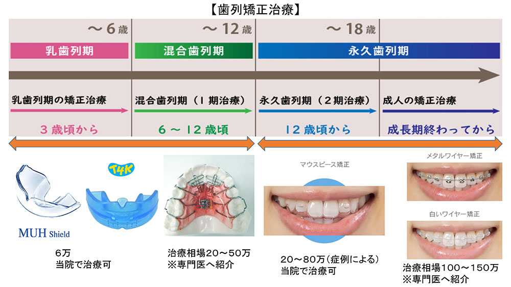 歯列矯正治療