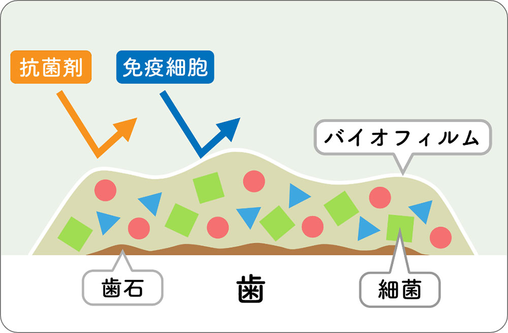 バイオフィルム除去の重要性