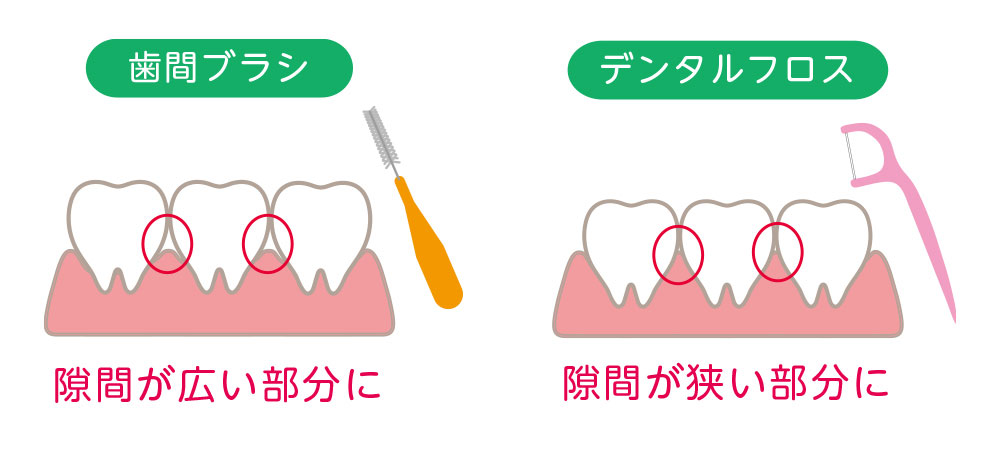 ホームケアの重要性：プロケアを活かす毎日の習慣